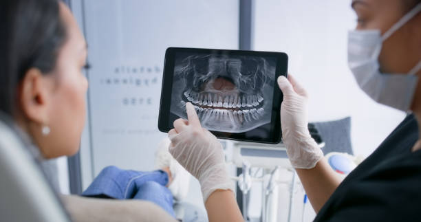 Licensed Tooth Extraction service in Union City, GA - Smile Center Dentistry